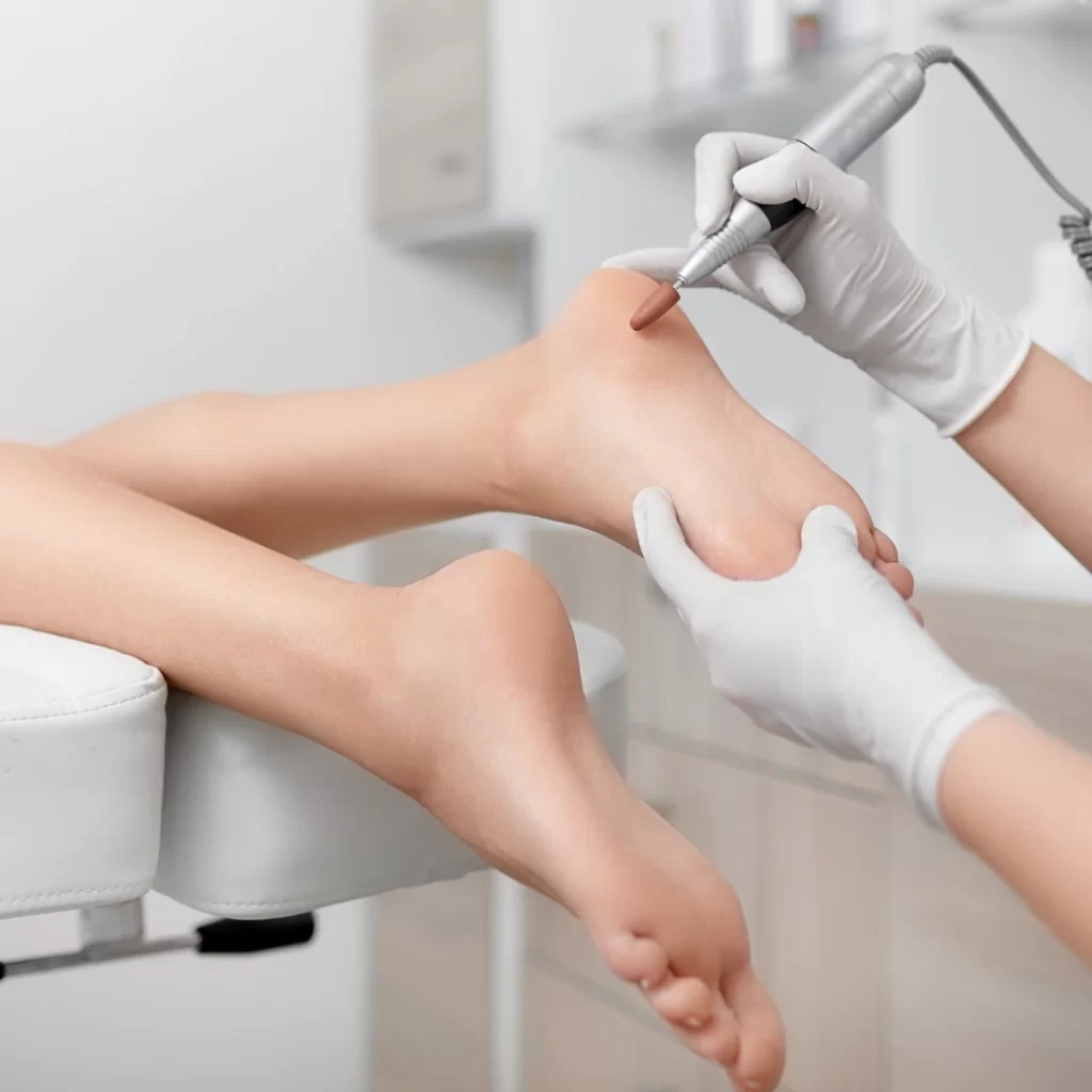 soins podologiques sept medico esthetique 3