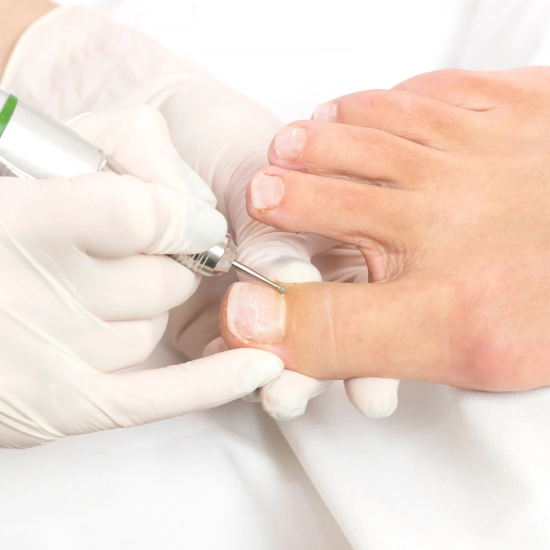 soins podologiques sept medico esthetique 5