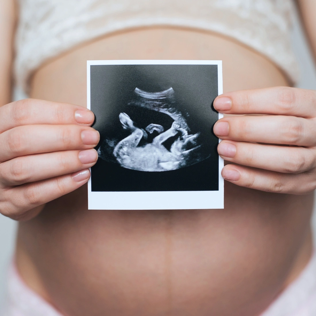 femme enceinte perinataux sept medico esthetique 5 1