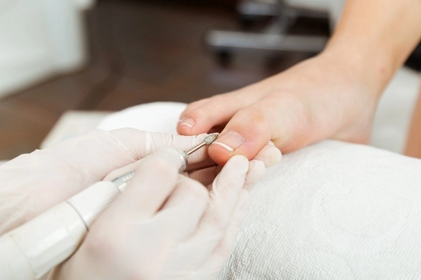 soins podologiques clinique sept medico esthetique(1)
